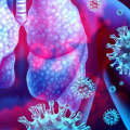 Strengthen Your Immune System to Prevent Covid-19